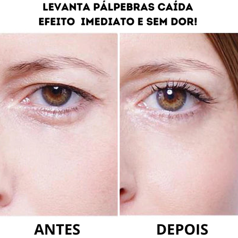 Palp Lifting Levanta Pálpebras Caídas